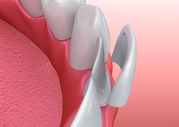 maple ridge cosmetic dentistry 